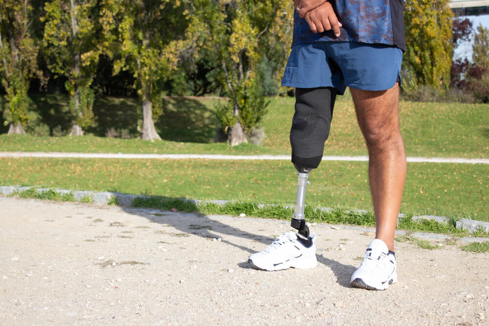 Prosthetic Devices
