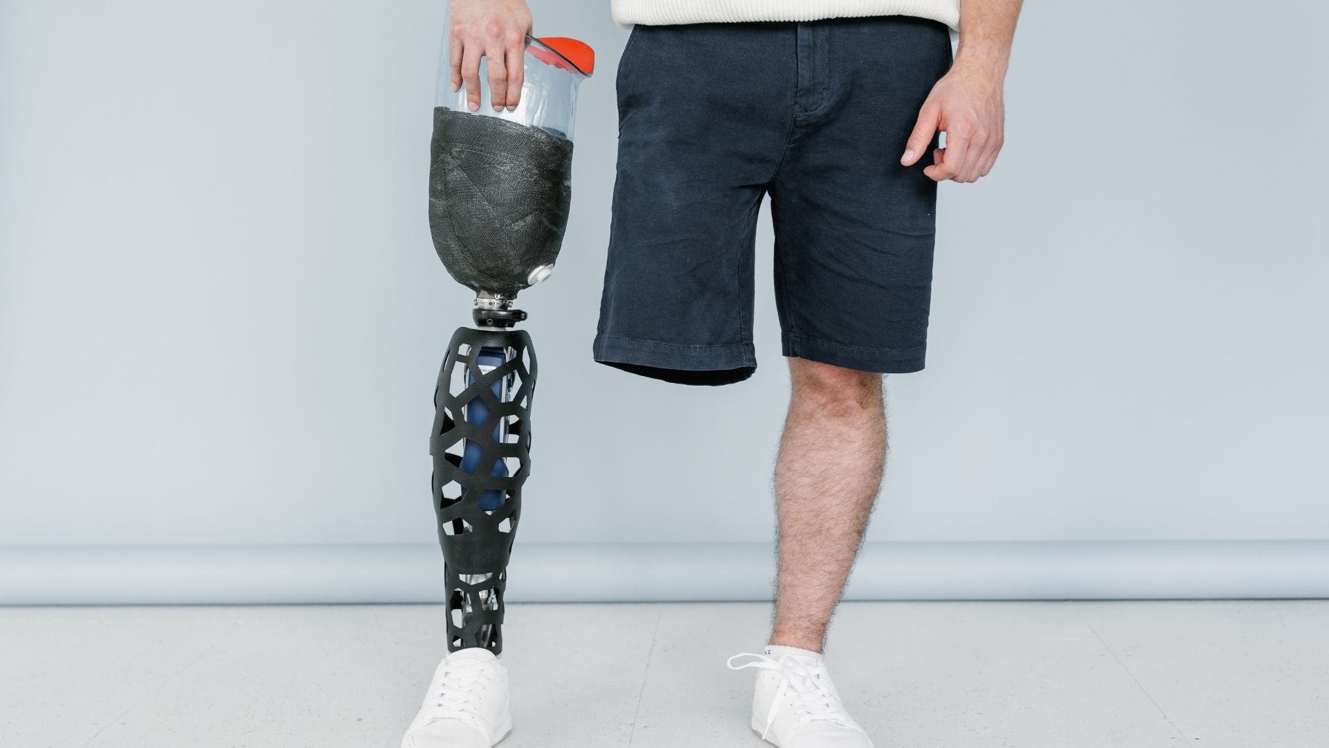 Amputation_Related_To_Diabetes Blog - Orthopedic Appliance Company, Inc.