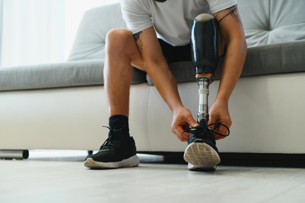 What_You_Need_To_Know_Before_Getting_A_Prosthetic_Leg_ Blog - Orthopedic Appliance Company, Inc.