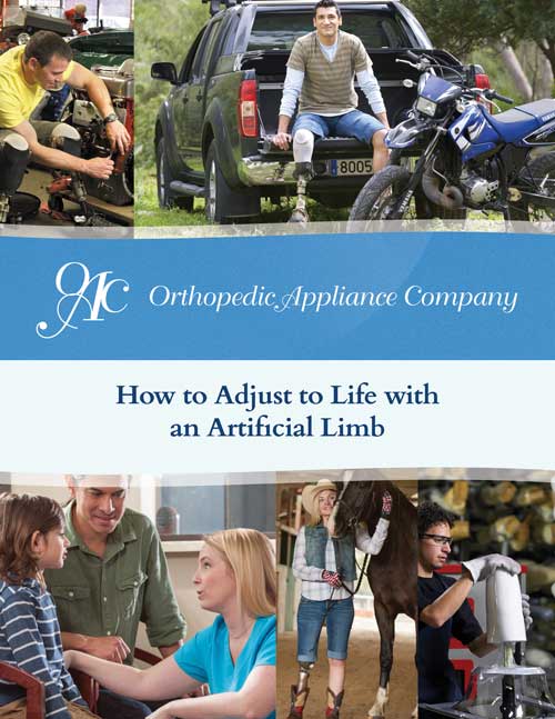 How to adjust to life with an artificial limb