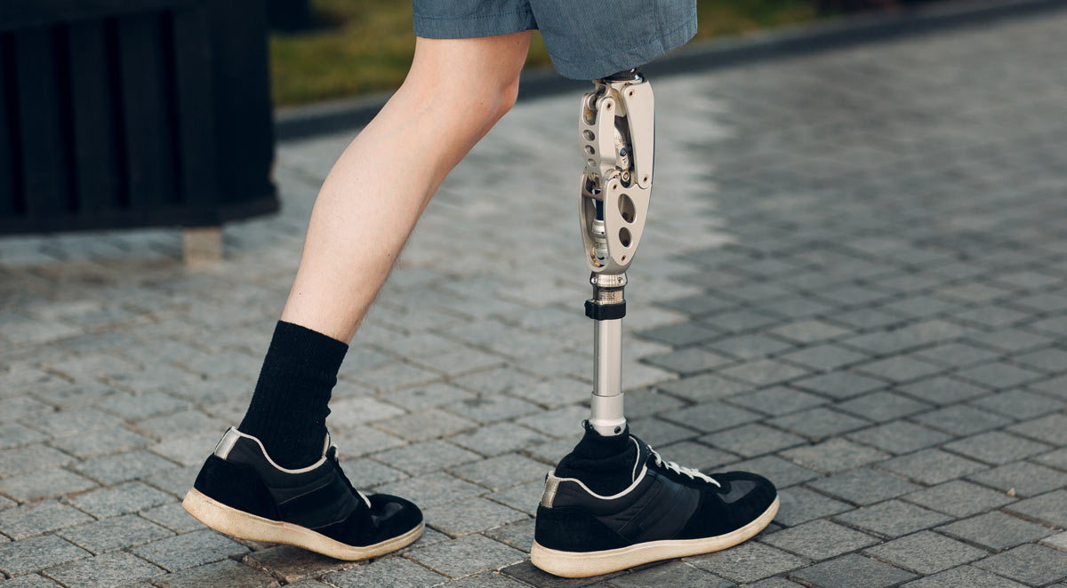 Prosthetic Devices Hickory, NC