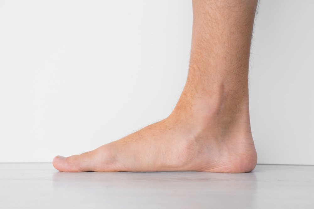 Flat Foot Insole Bryant, AR