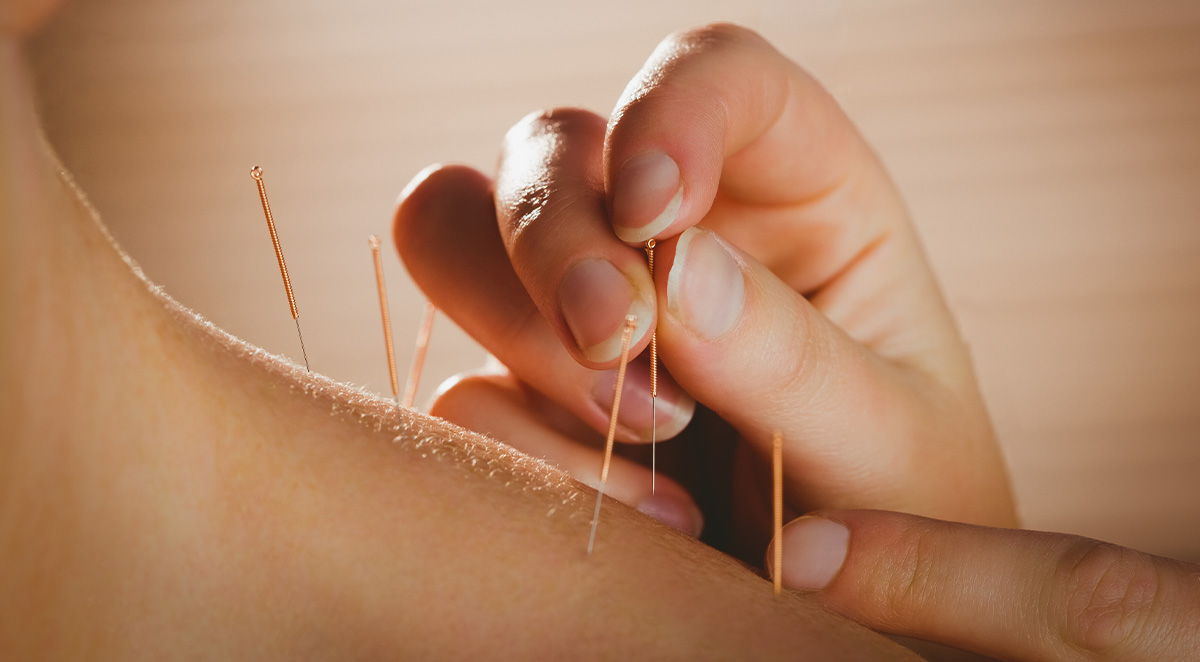 how_is_phantom_limb_pain_treated image how is phantom limb pain treated