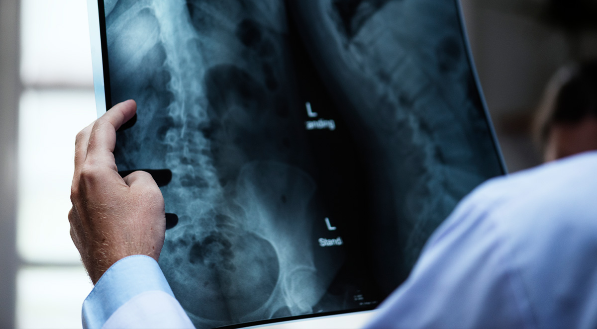 braces for scoliosis